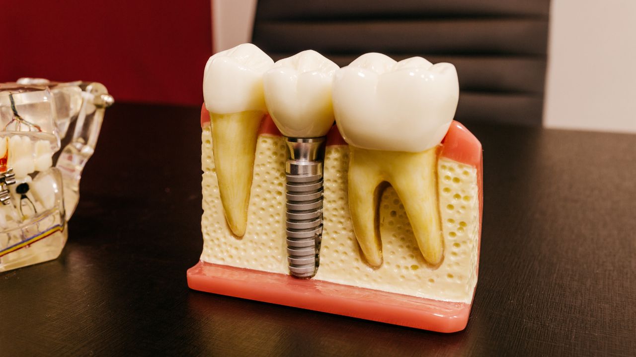 Réparer ou remplacer un composite : critères de décision