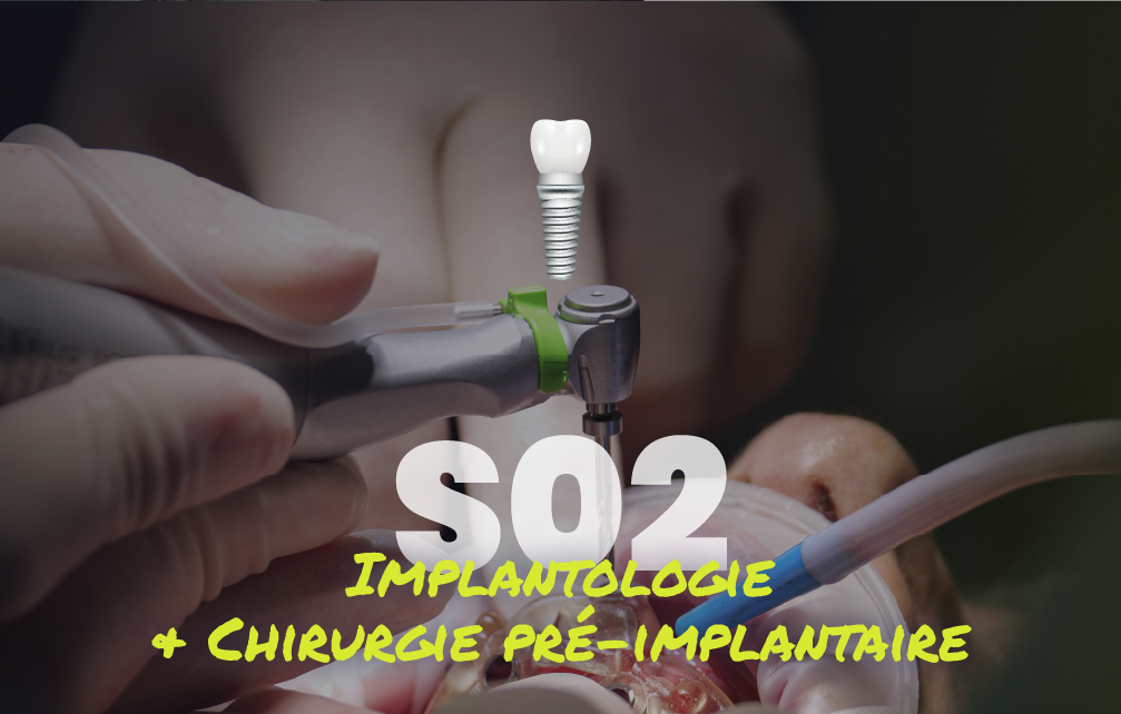 Implantologie et chirurgie pré-implantaire - Saison 2