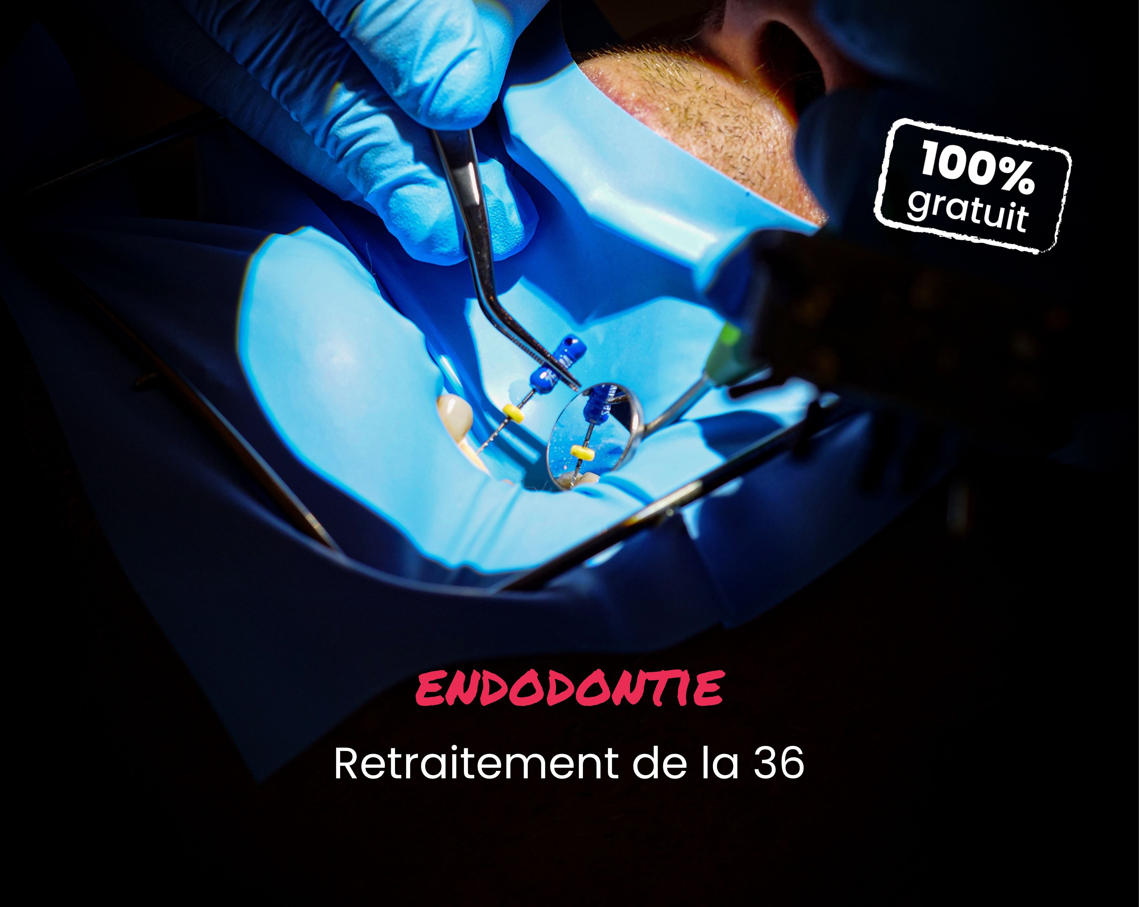 Extrait offert - MasterClass Endodontie - Retraitement de la 36