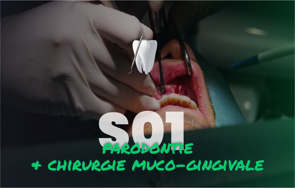 Parodontie & Chirurgie muco-gingivale - Saison 1