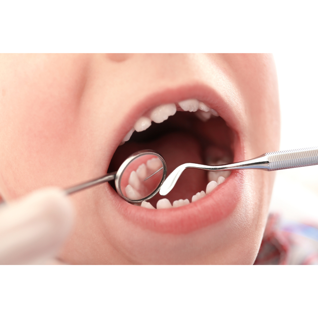 Approche clinique et traitement en pédodontie : soins dentaires spécifiques aux jeunes patients