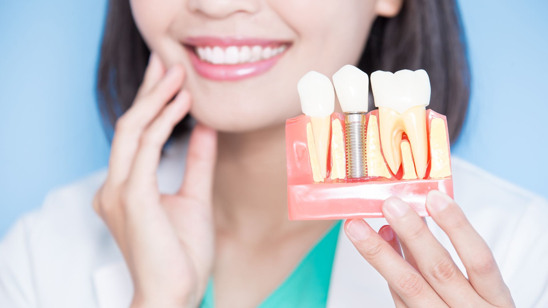 Implant dentaire vs prothèse : que choisir selon votre cas ?