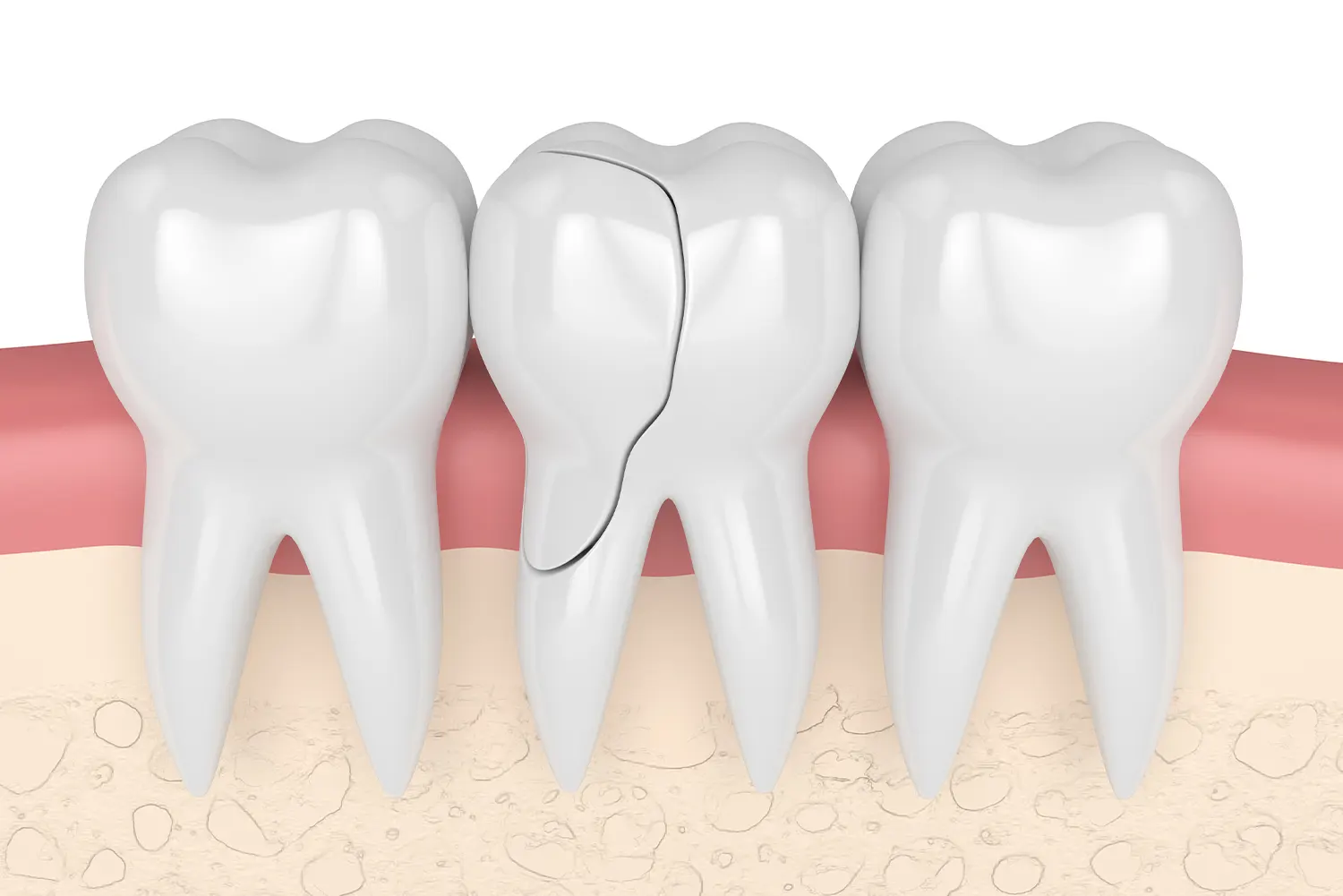 Dental Emergencies: What to Do When Accidents Happen