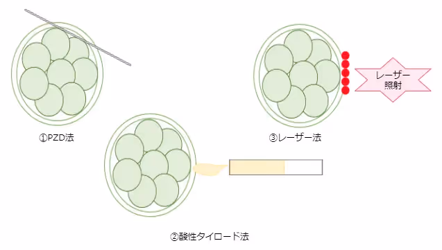 AHA(アシステッドハッチング)の方法