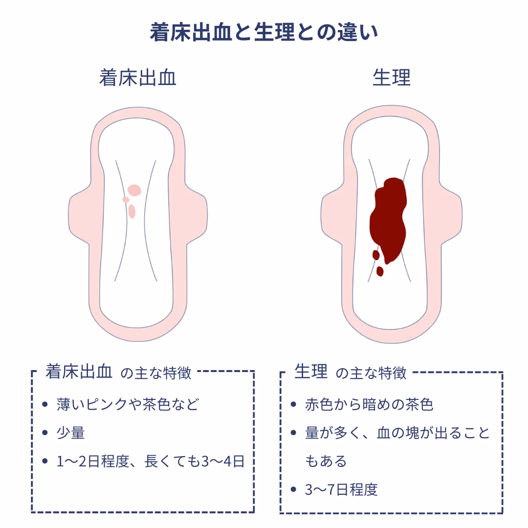 着床出血と生理との違い