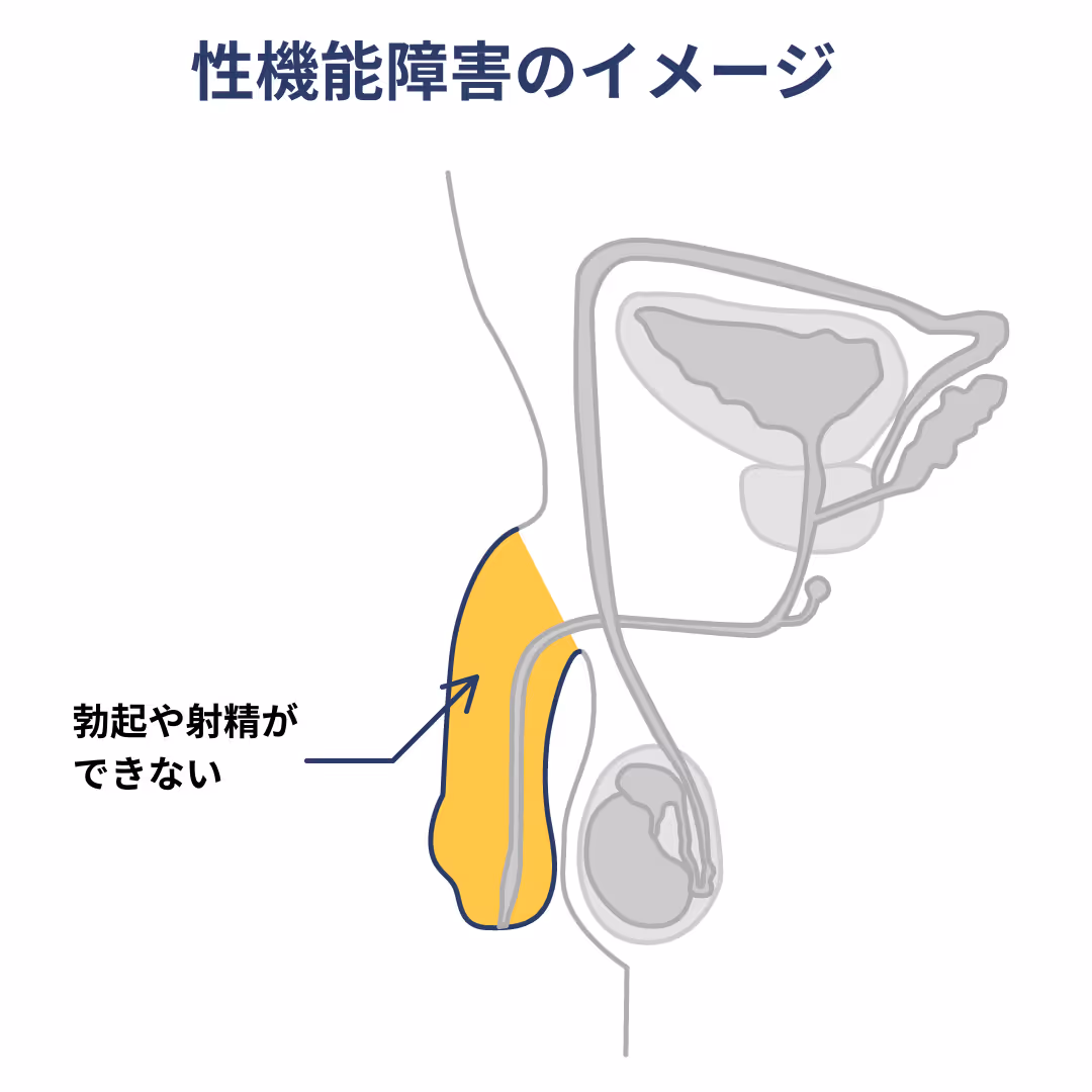 性機能障害のイメージ