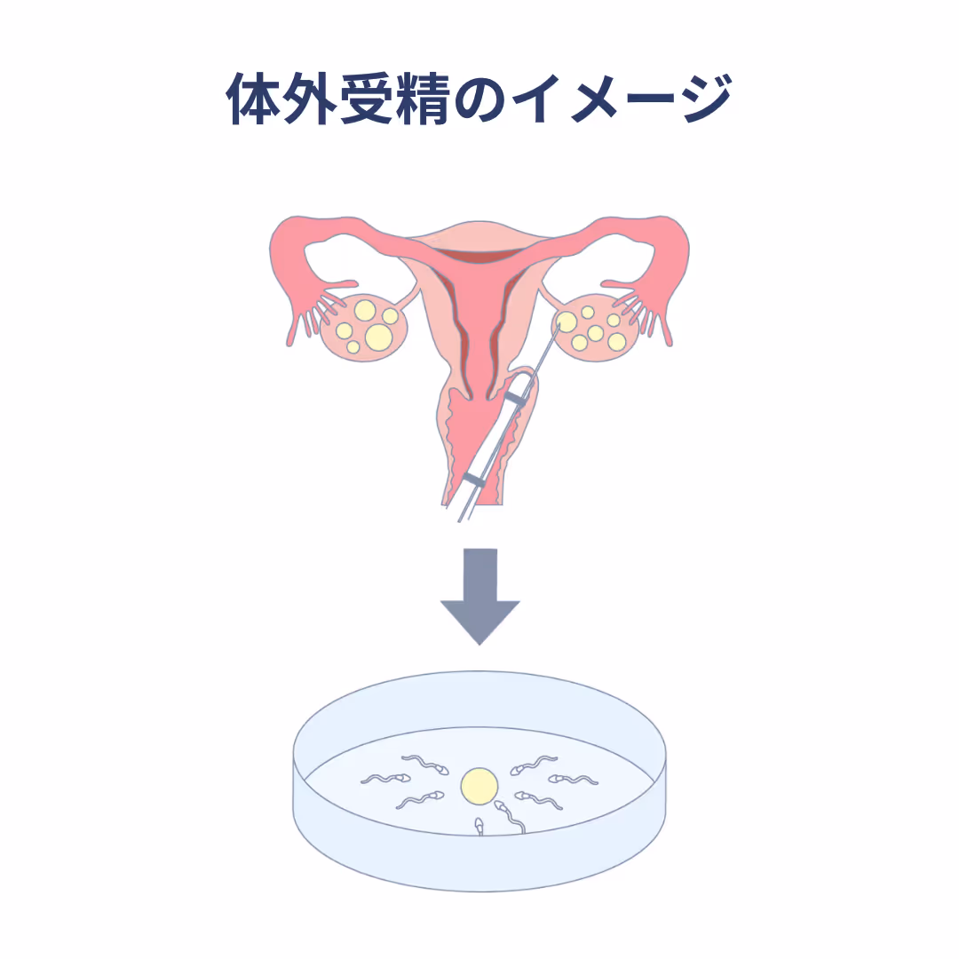 体外受精のイメージ