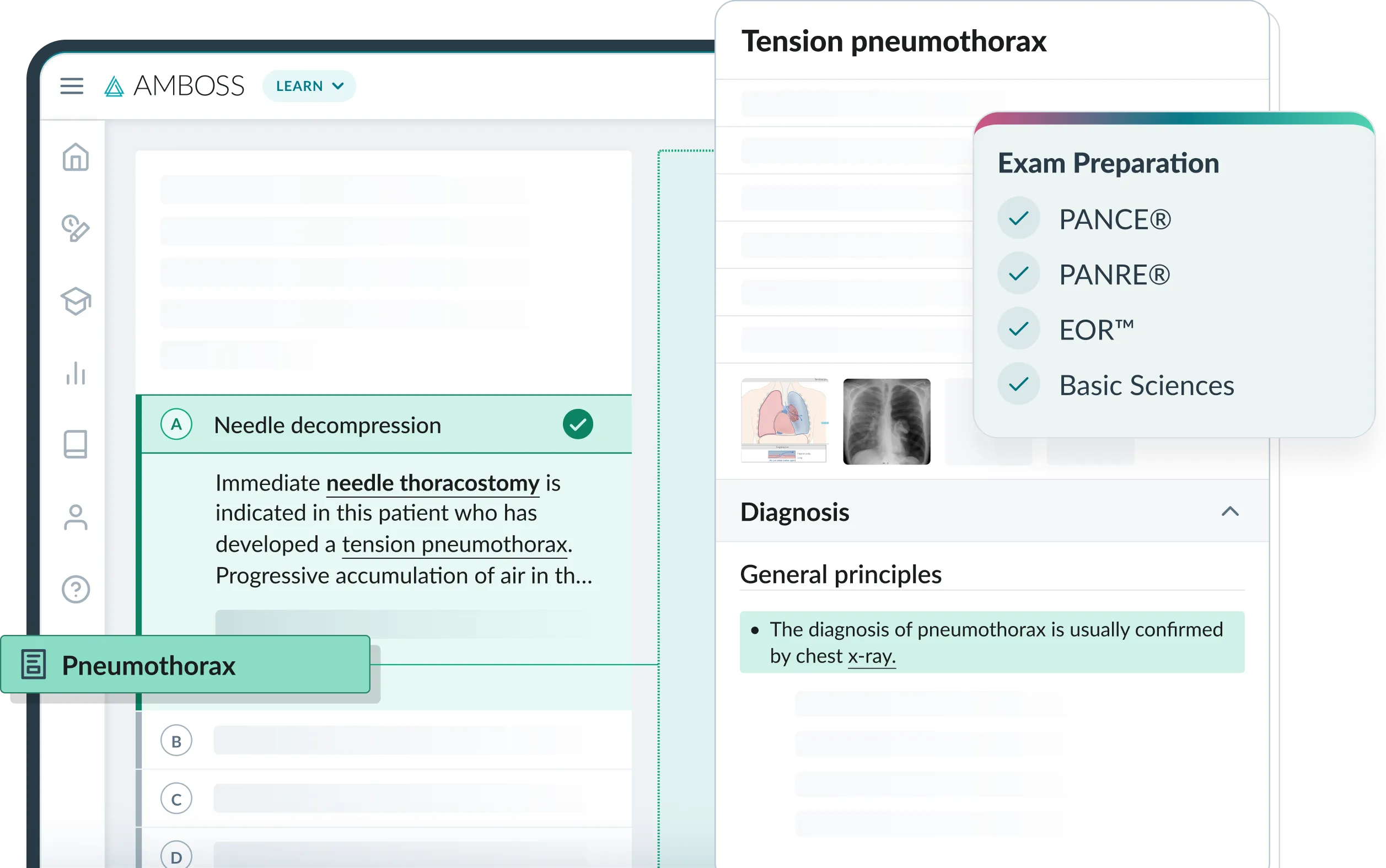 A desktop showing a question session from the AMBOSS Qbank with an explanation o the correct answer displaying a Library articles in split-view, and a checklist confirming the the Qbank is suitable for PANCE, PANRE, EOR, and basic sciences exams