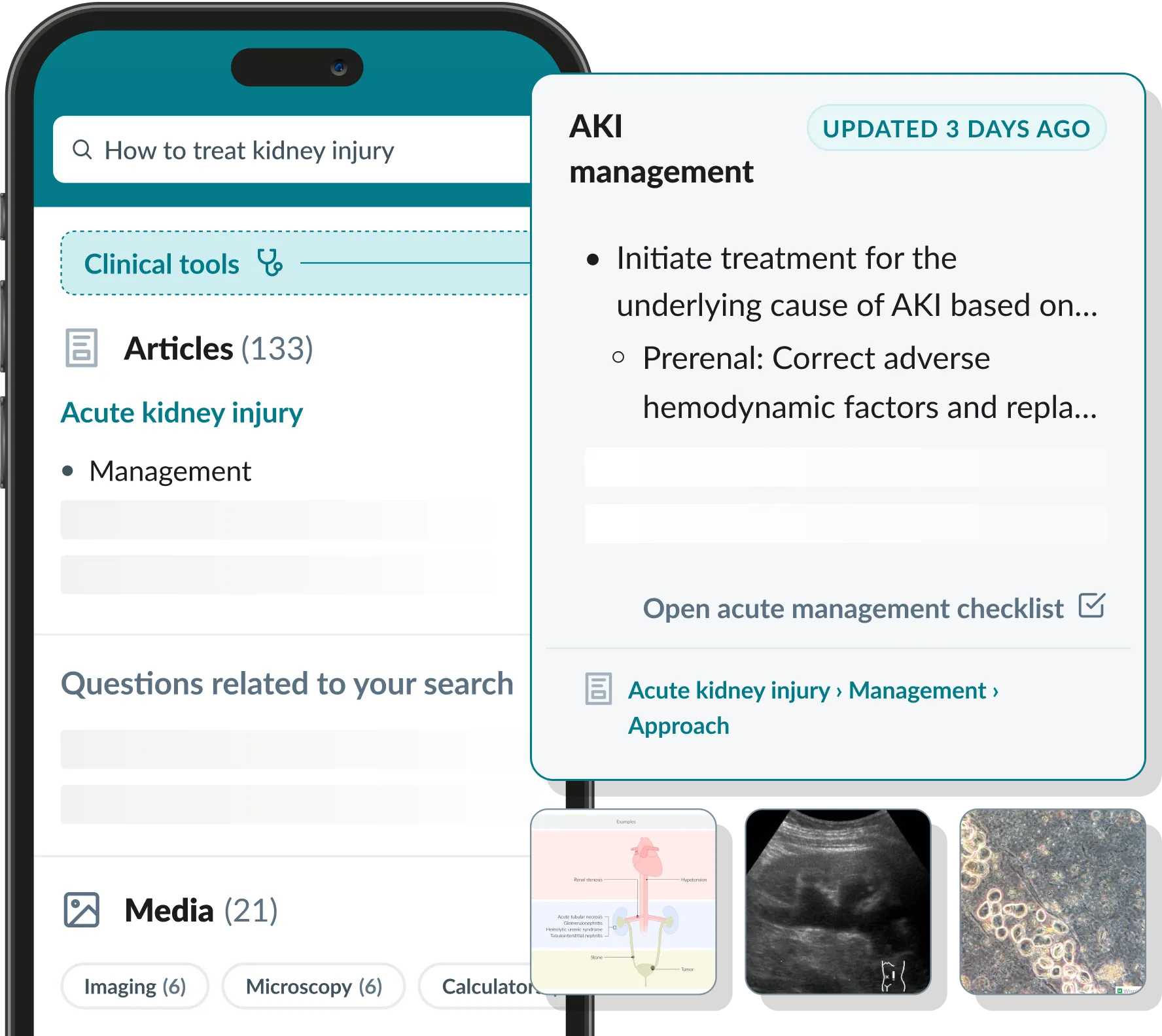 A mobile phone showing an article from the AMBOSS Library for clinical year PA students looking up how to treat kidney injury, with an acute management checklist updated 3 days ago
