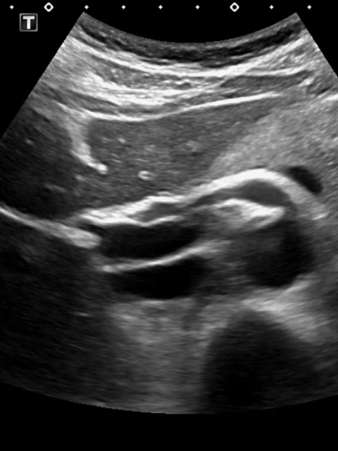 AMBOSS point-of-care ultrasound (POCUS) imaging for clinical diagnosis.