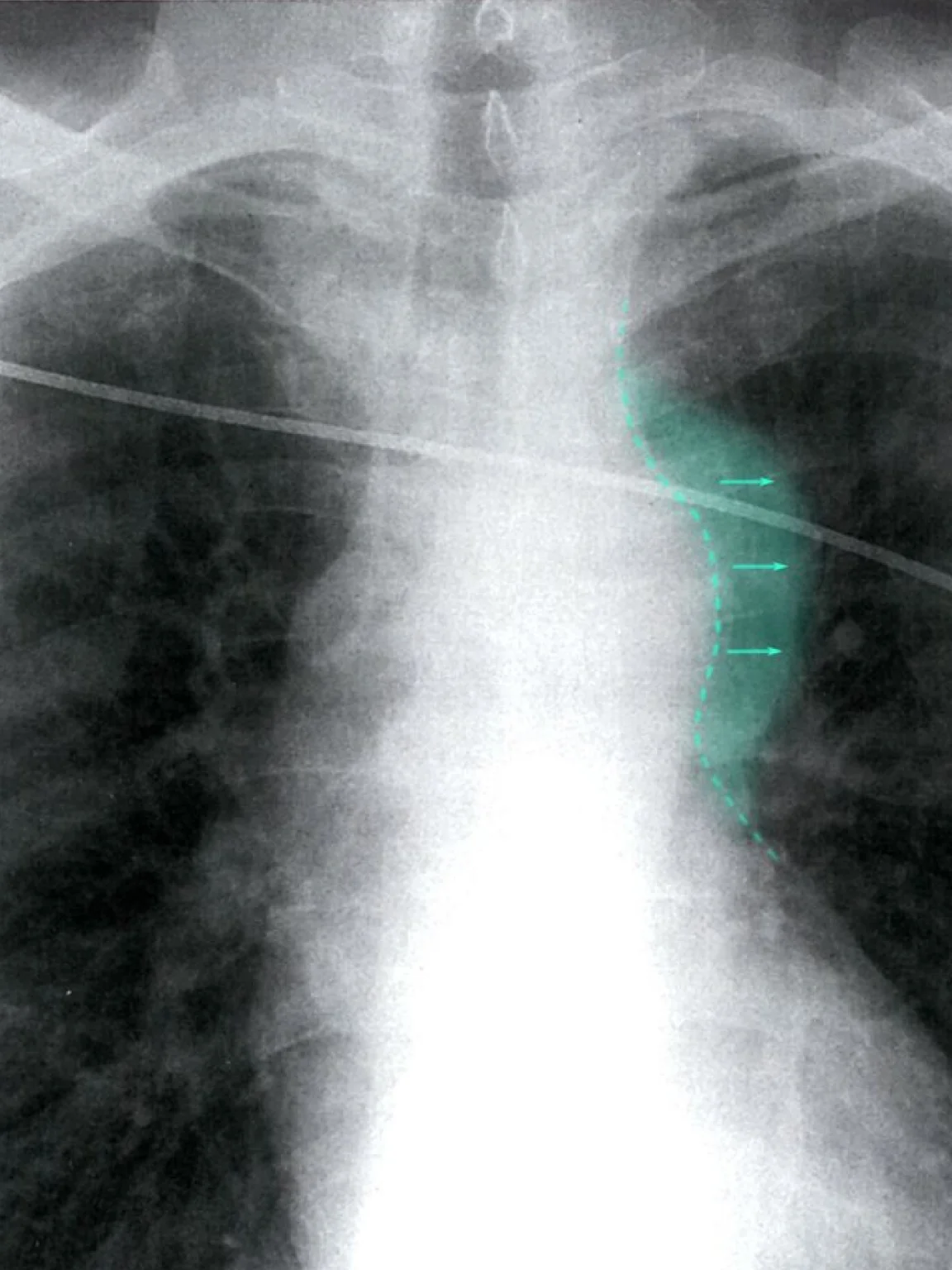 Radiology overlay and interpretation tools for resident clinical reasoning.