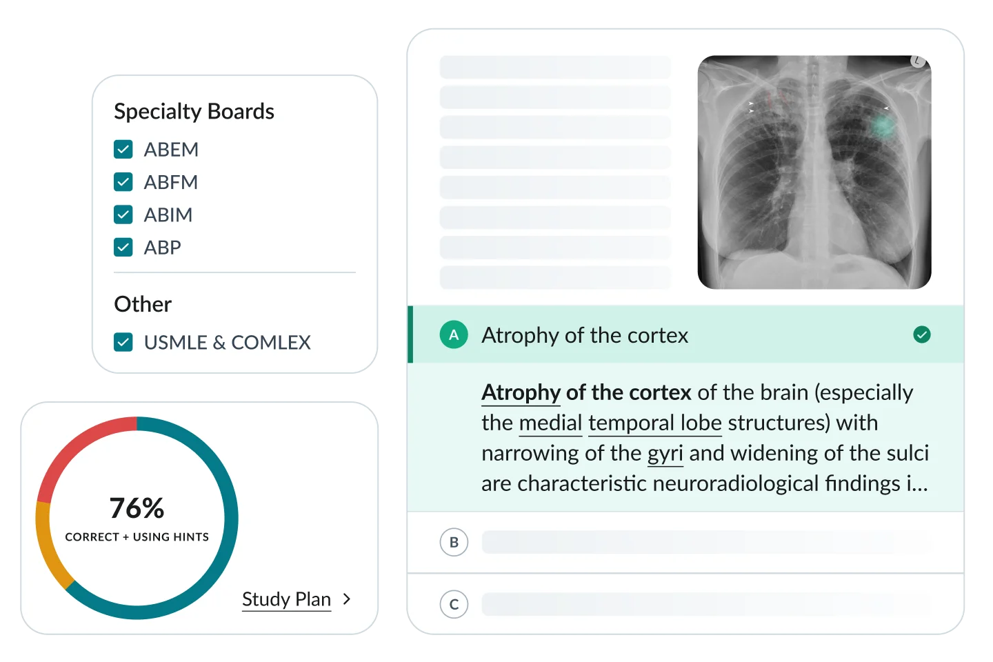 AMBOSS residency platform interface showing specialty board selection, performance analytics with a 76% correct rate, and a clinical Qbank question with chest X-ray and explanation.