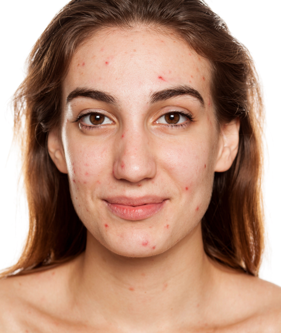 cute brown hair woman with beautiful skin