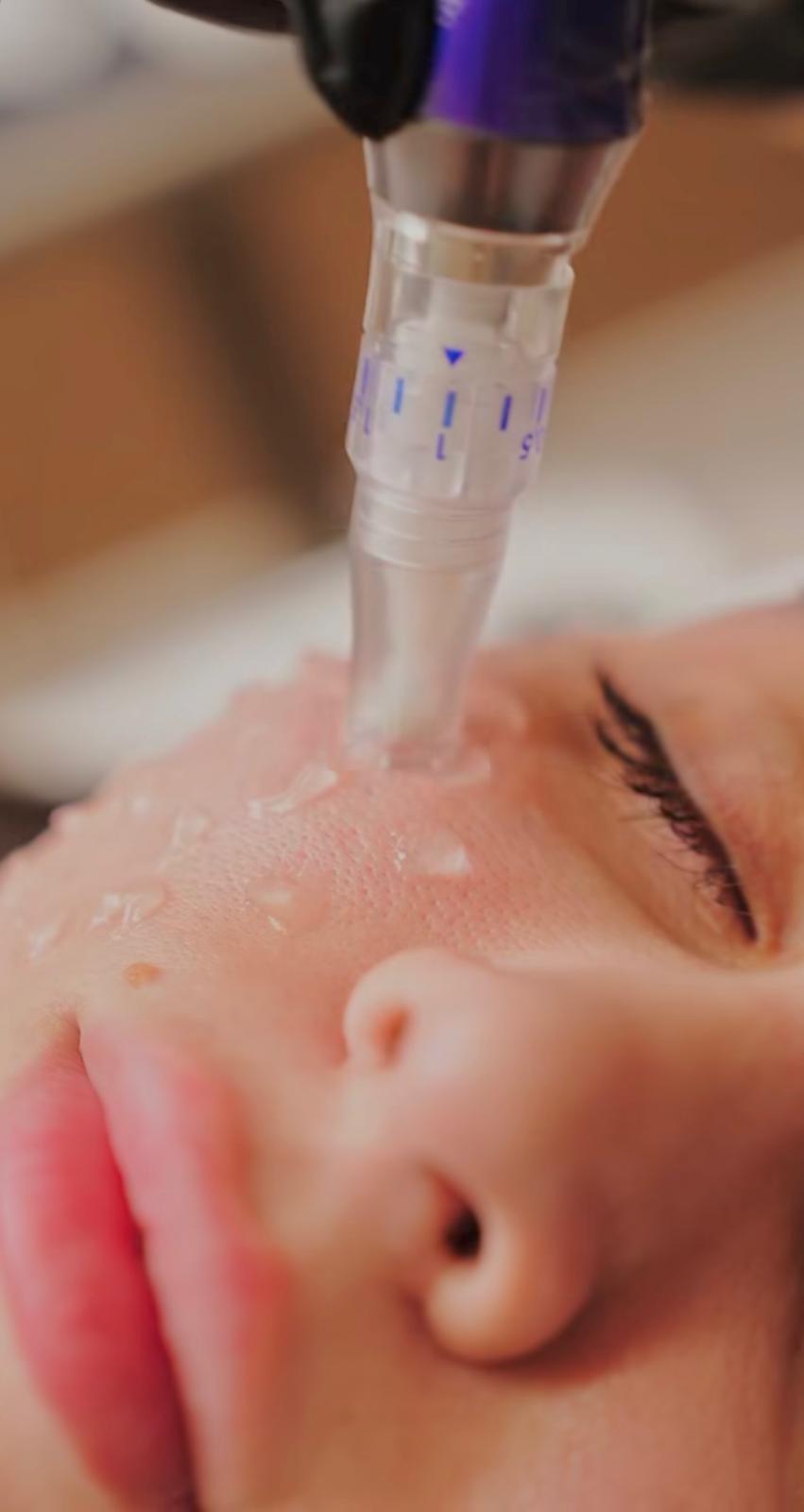 Lashlifting Otbote