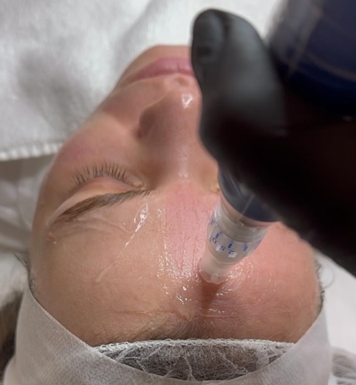 Otbote Lashlifting