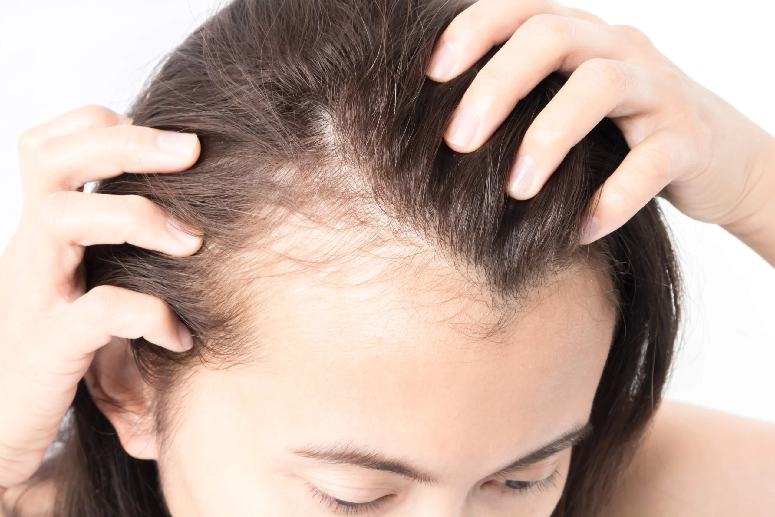 Hair Rejuvenation Vivace