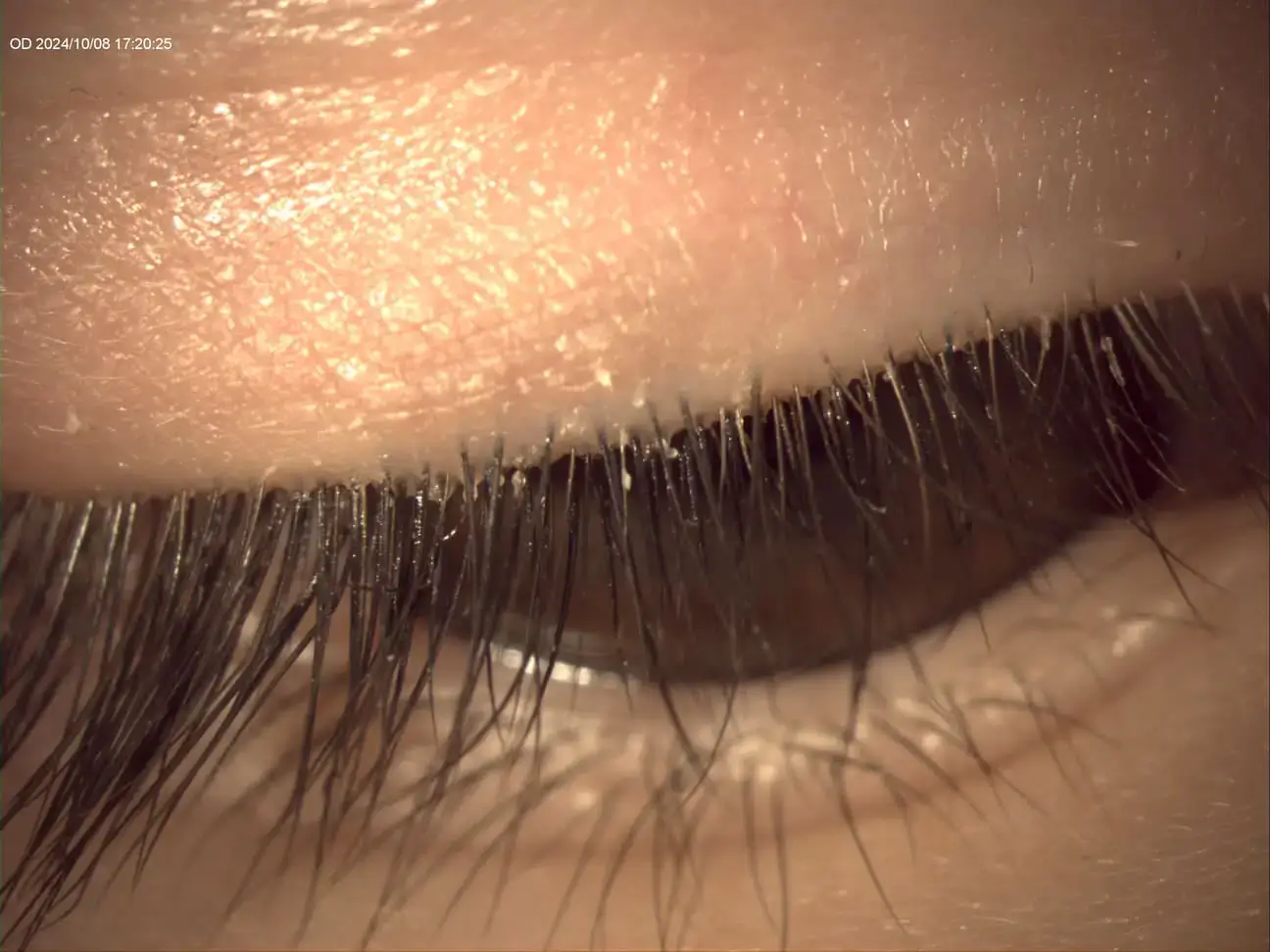 __wf_reserved_inherit