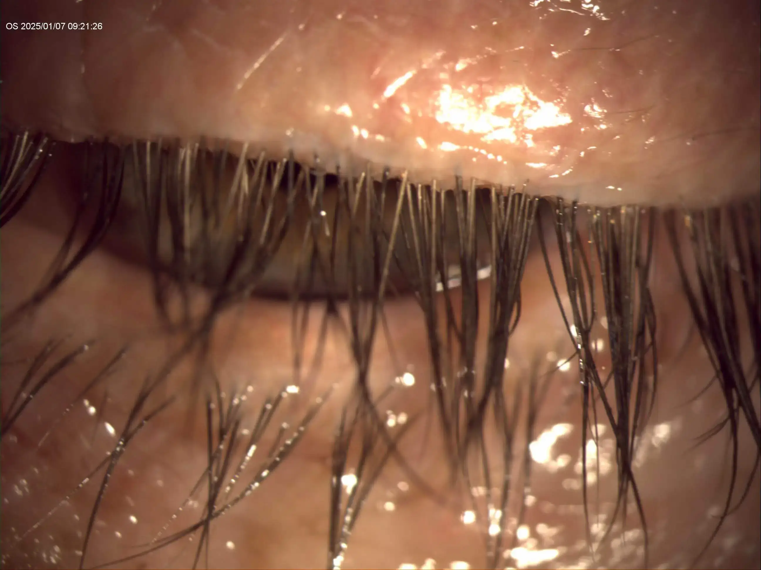 __wf_reserved_inherit