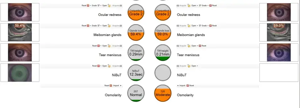 __wf_reserved_inherit