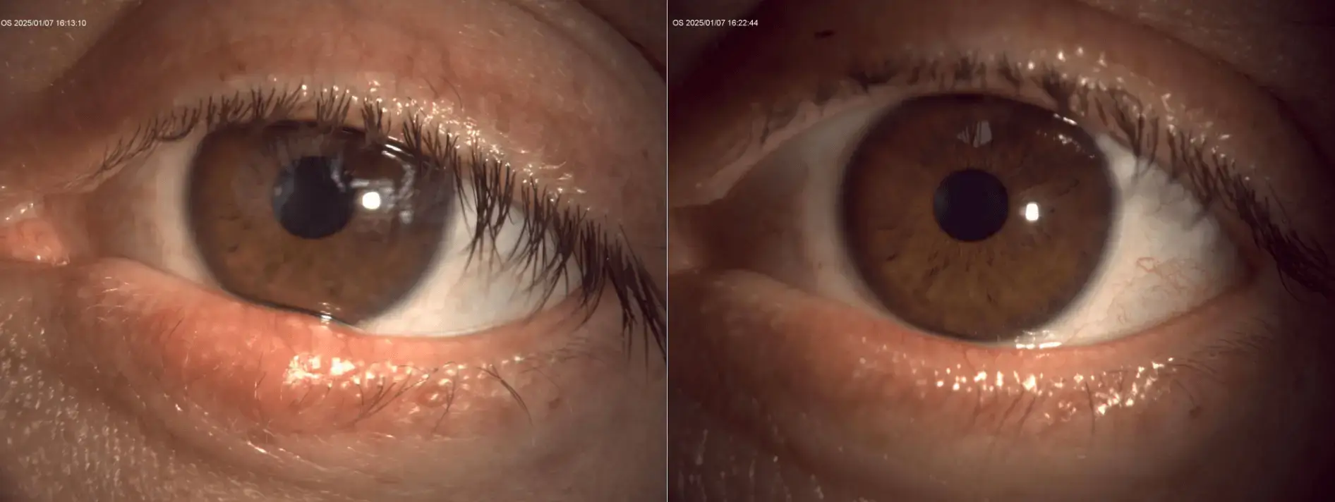 __wf_reserved_inherit