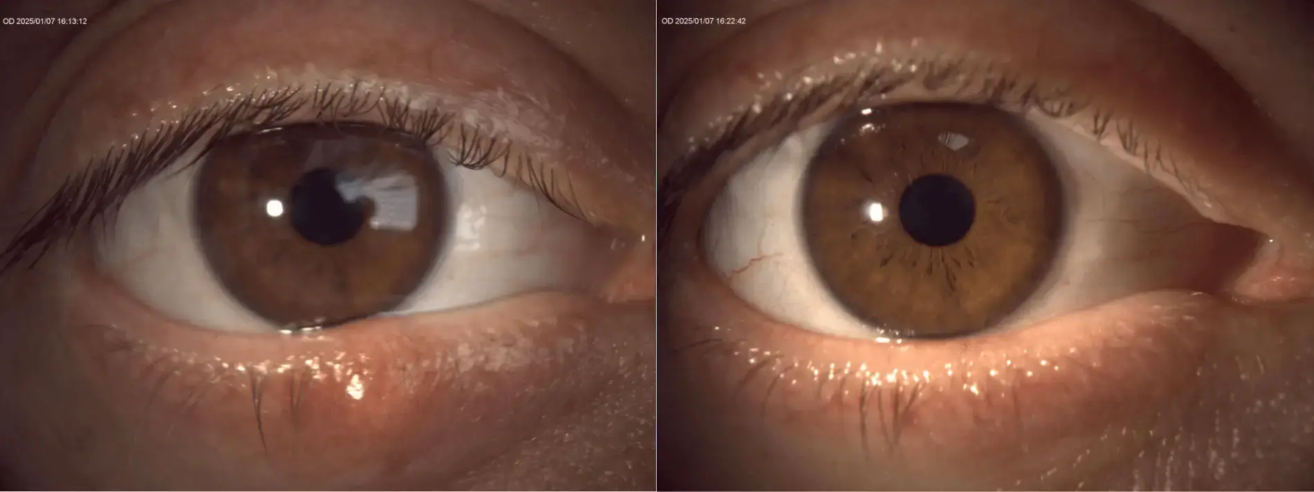 __wf_reserved_decorative