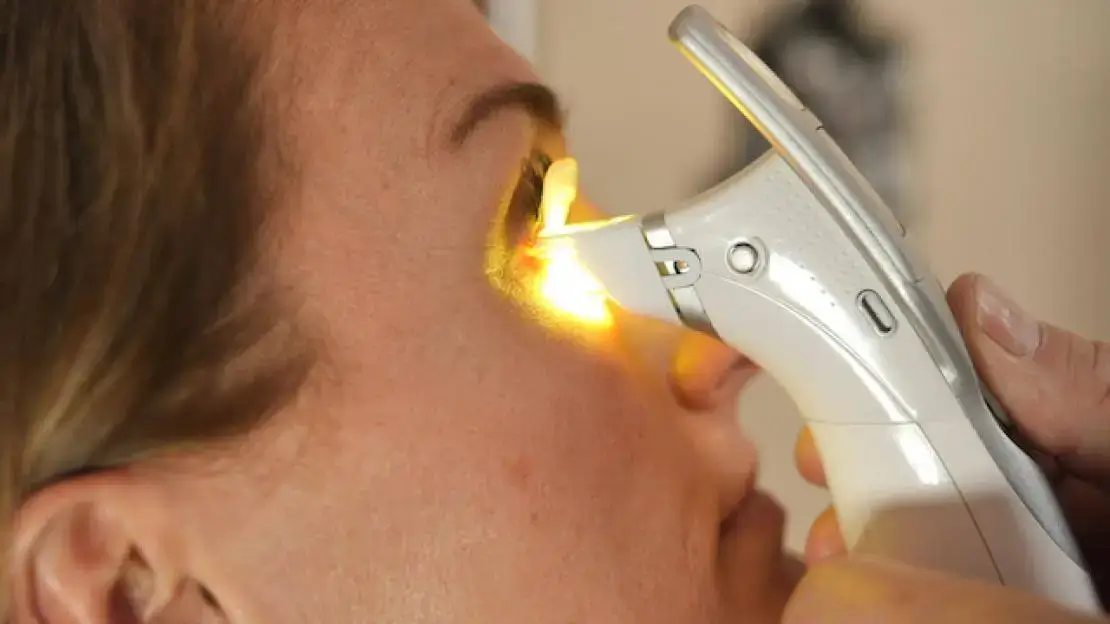 A woman is doing ilux treatment for dry eye
