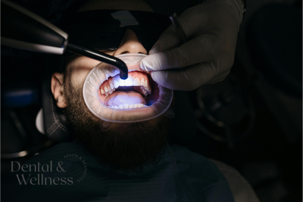 back tooth cavity filling