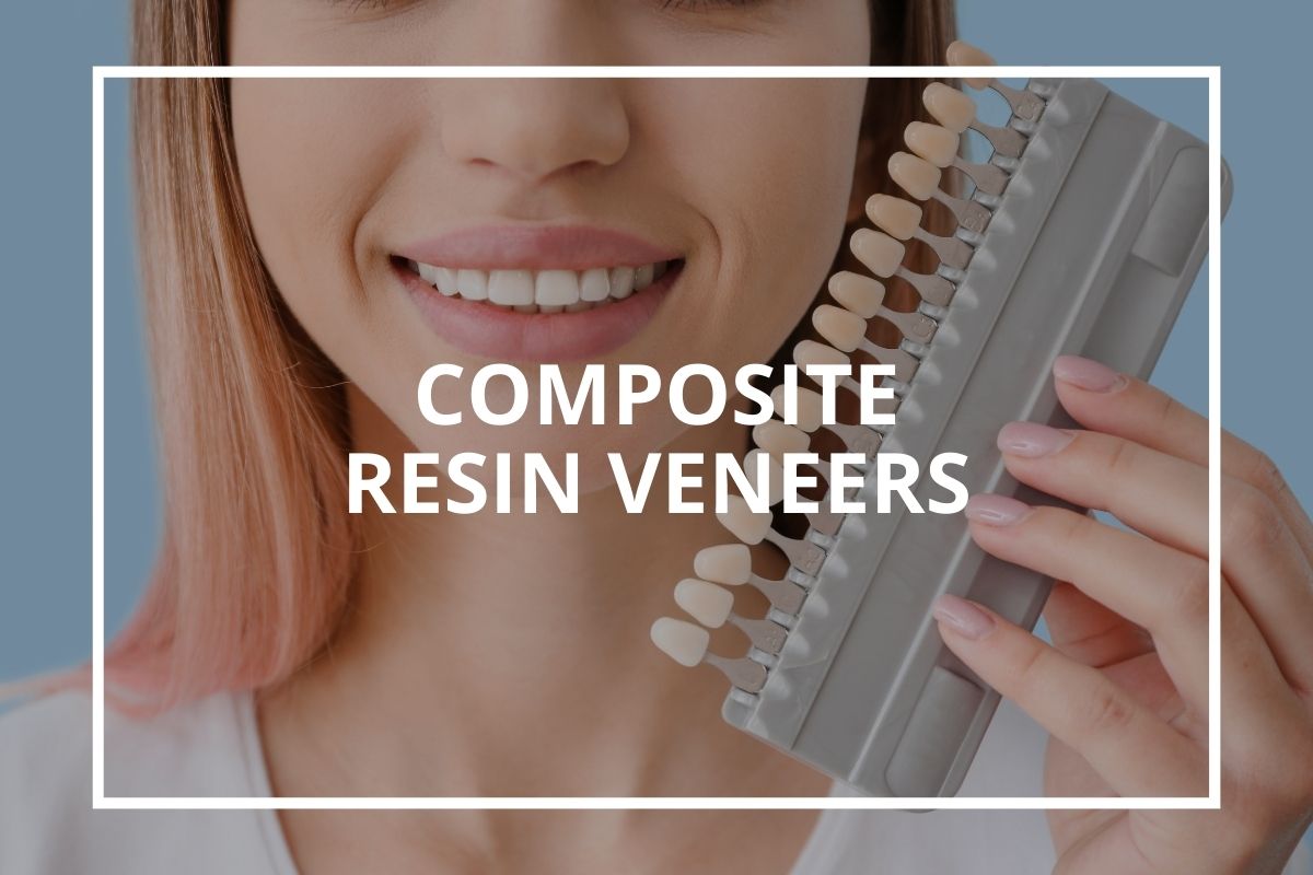 Composite resin veneers