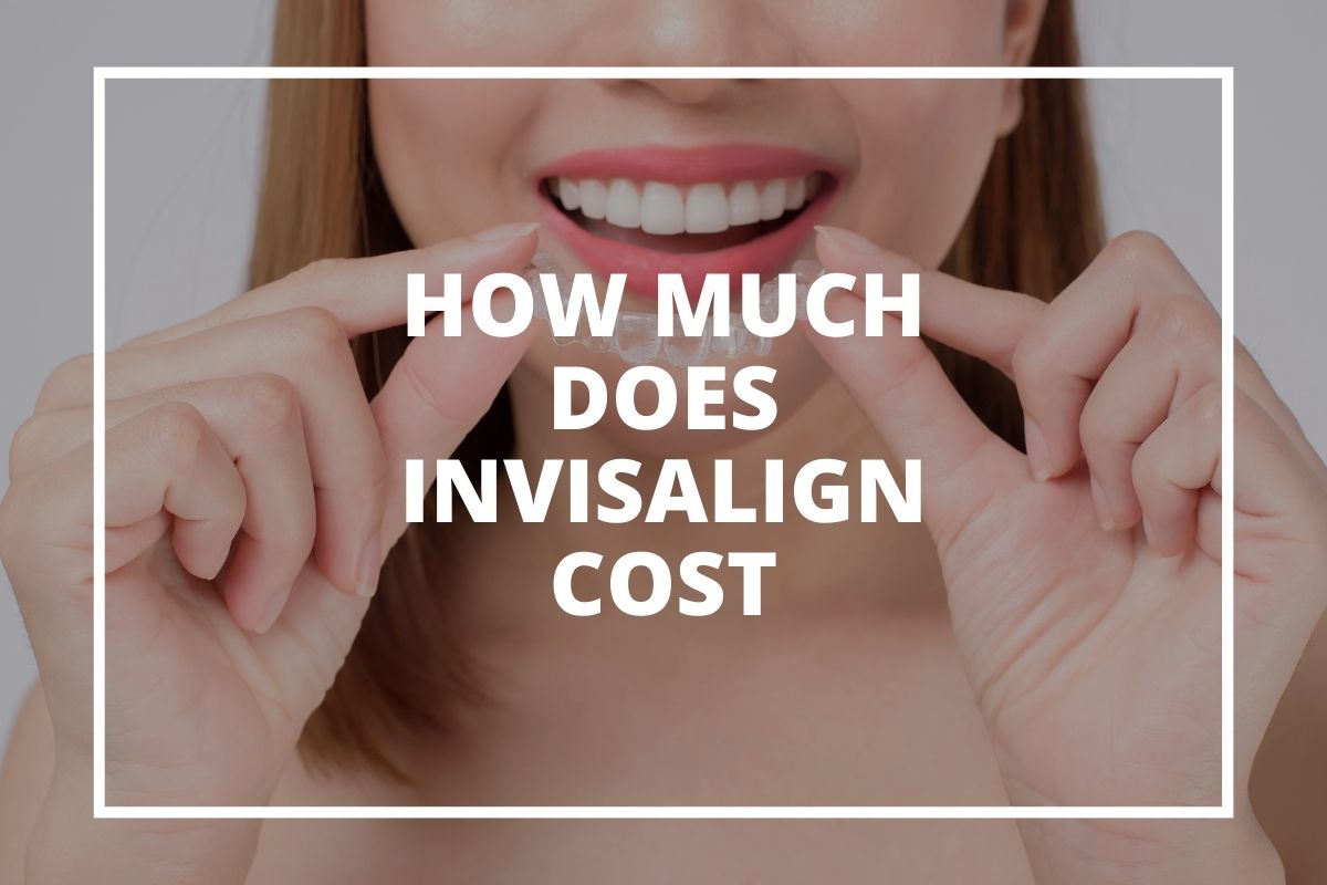 Invisalign clear aligners