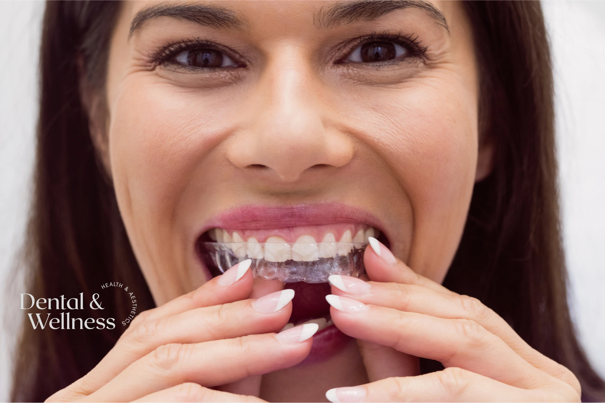 Cleaning a dental night guard