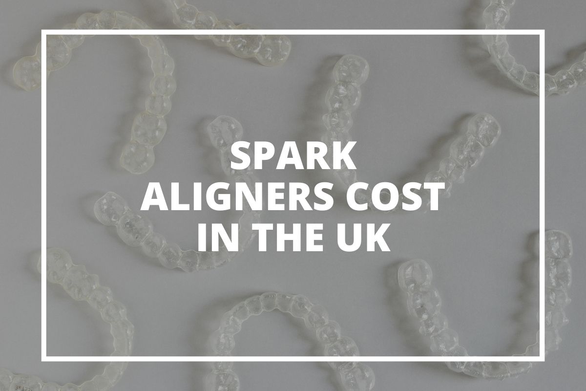 Spark clear aligners