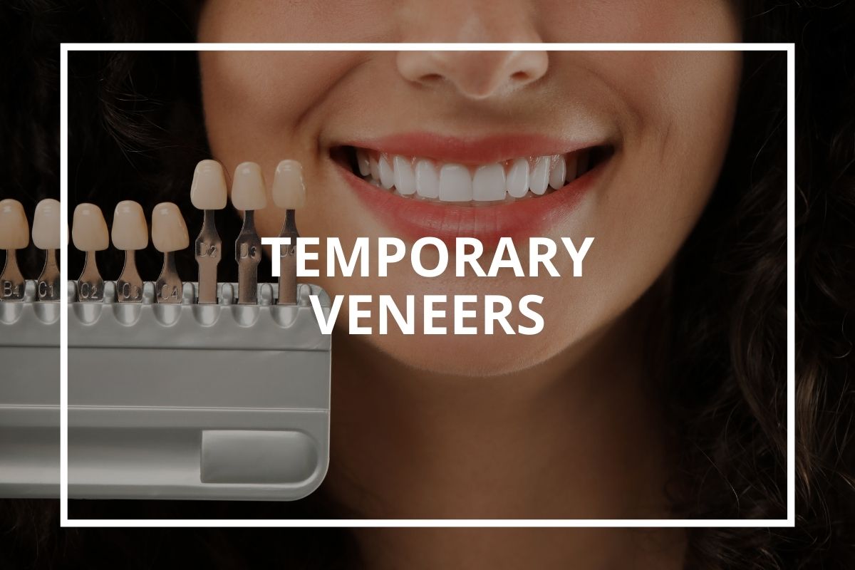 Temporary dental veneers