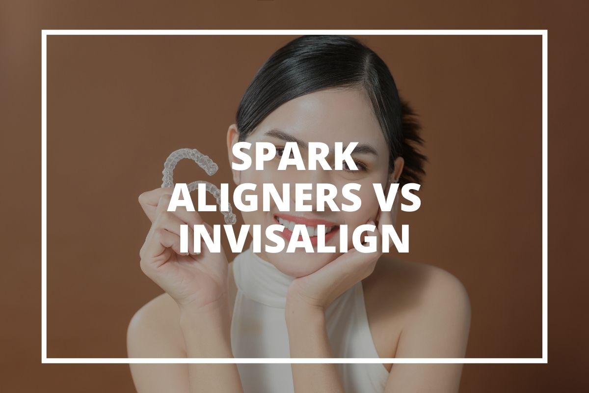 Spark aligners and Invisalign