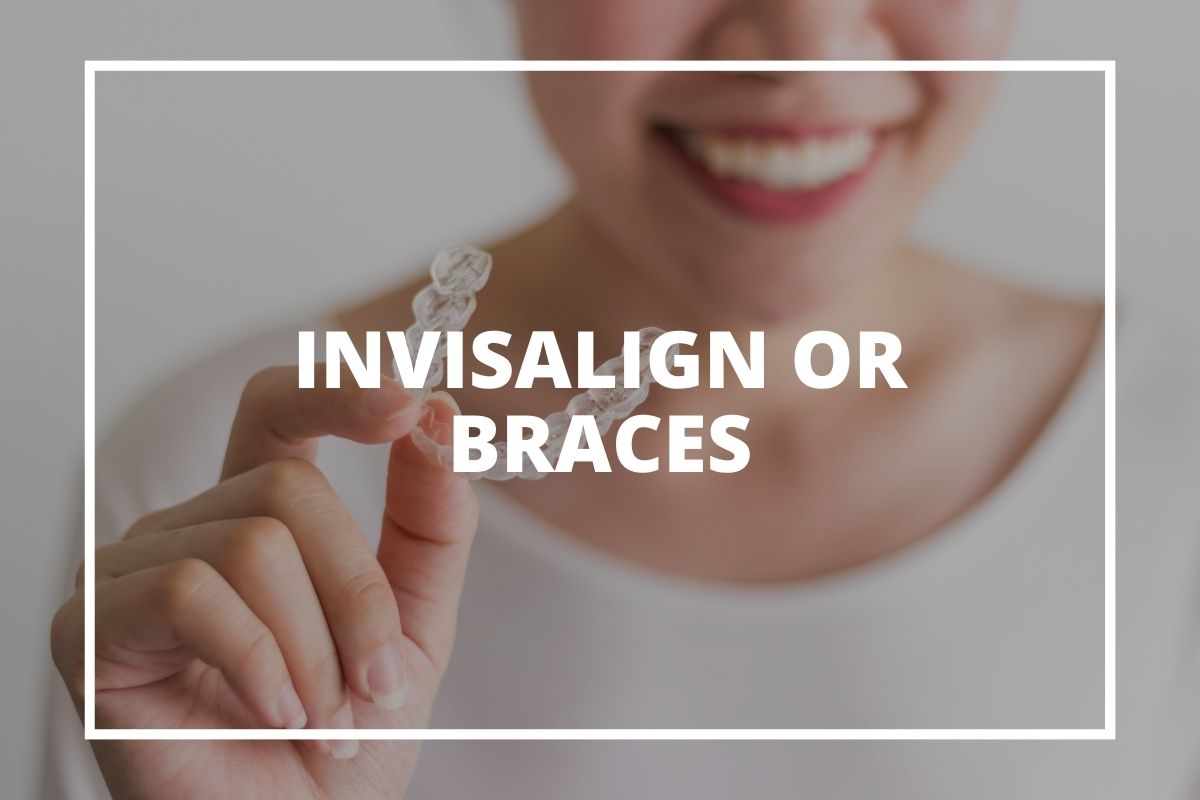 Invisalign aligners and braces compared