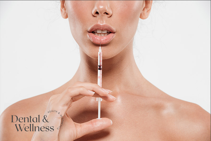 Lip flip treatment on the upper lip