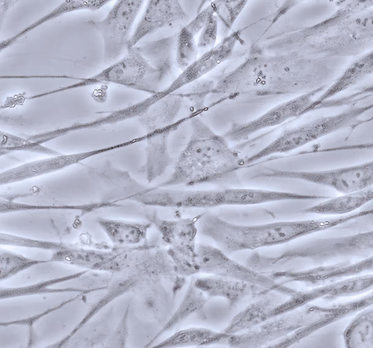 Pulmonary alveolar epithelial cells (PAEpiC) under microscope, used in lung disease and COPD research.