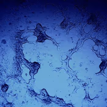 SMSbiotech Interviews with Dr. Roger Schechter EPISODE 1: Aging and Cell Therapy