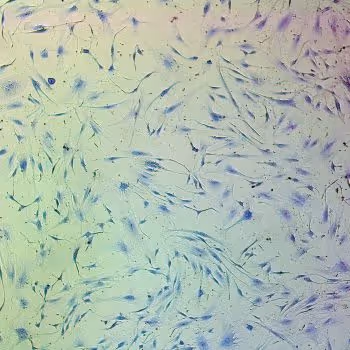 MSC's In the Treatment of COVID-19