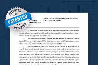 SMSbiotech Secures New Japanese Patent