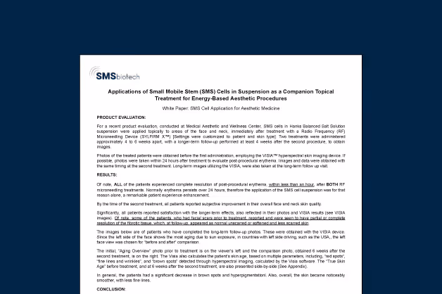 SMS Cells After RF Microneedling: New Evidence Shows Faster Recovery & Better Skin Quality