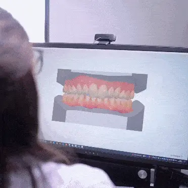 In-House 3D Printing Solution for Dentistry