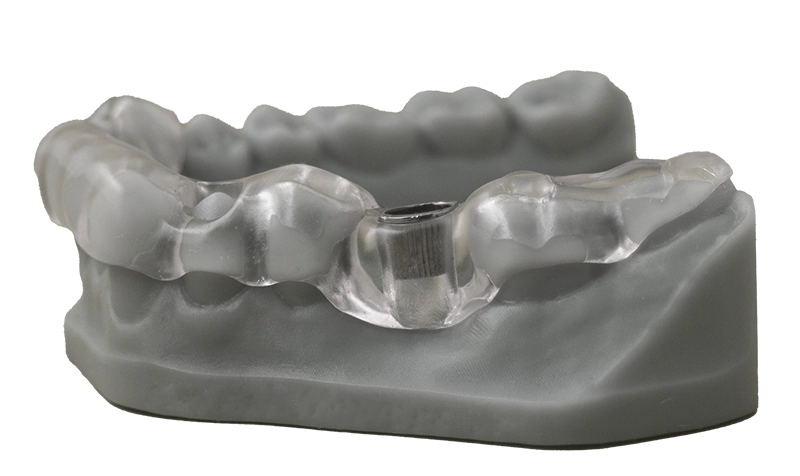 3D-Printed Surgical Guides