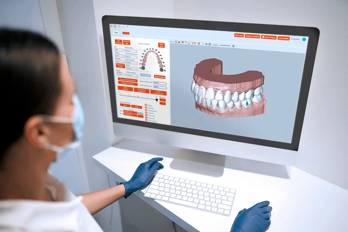 Sweeth Aligner software for orthodontic treatment planning