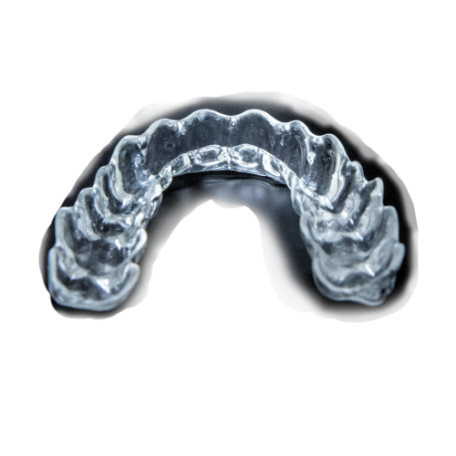 Gouttières de blanchiment imprimées en 3D