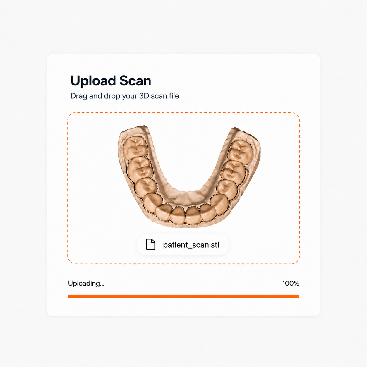 Upload Your Scan: Upload an intraoral scan and let AI automatically clean and prepare it for design.