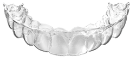 Transparent aligner