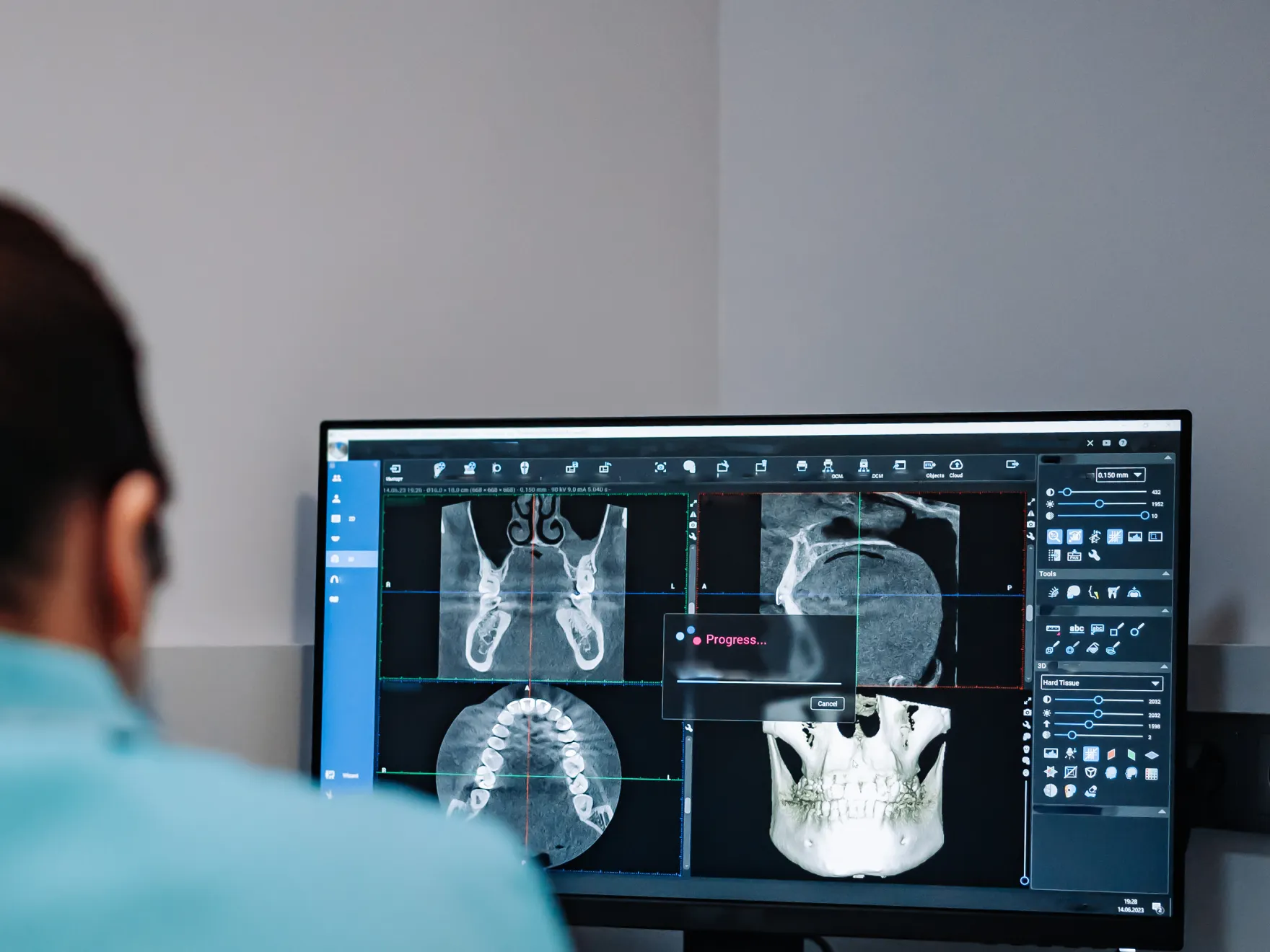 dental 3d imaging