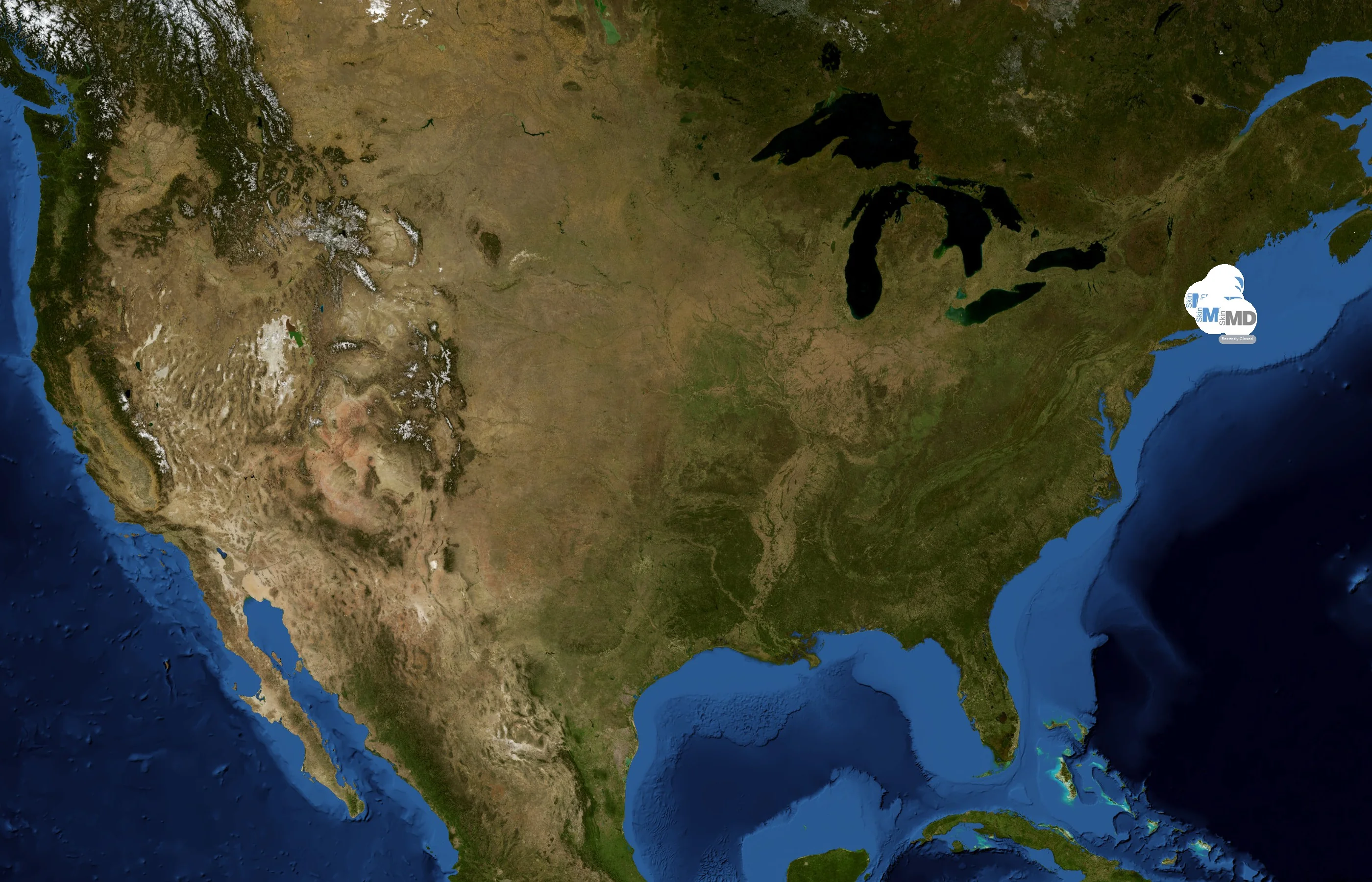 SkinMD state distribution