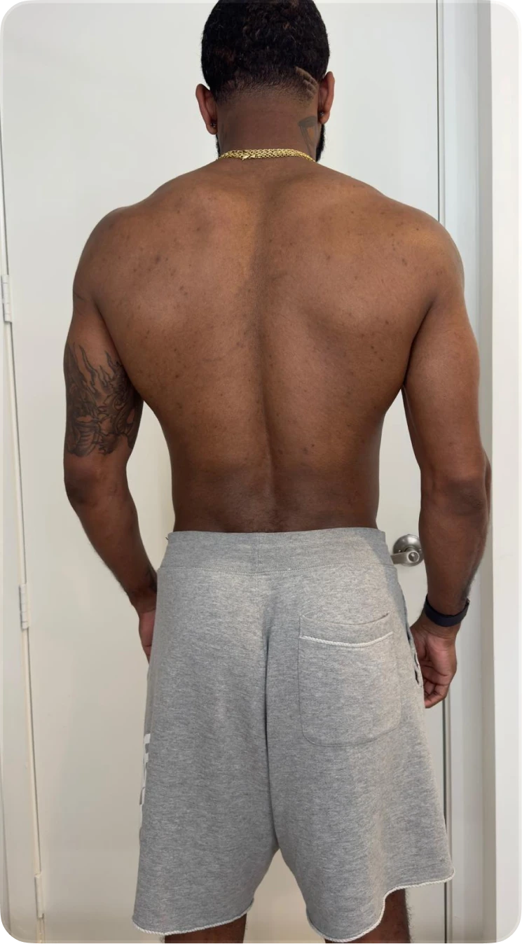 Branden back before