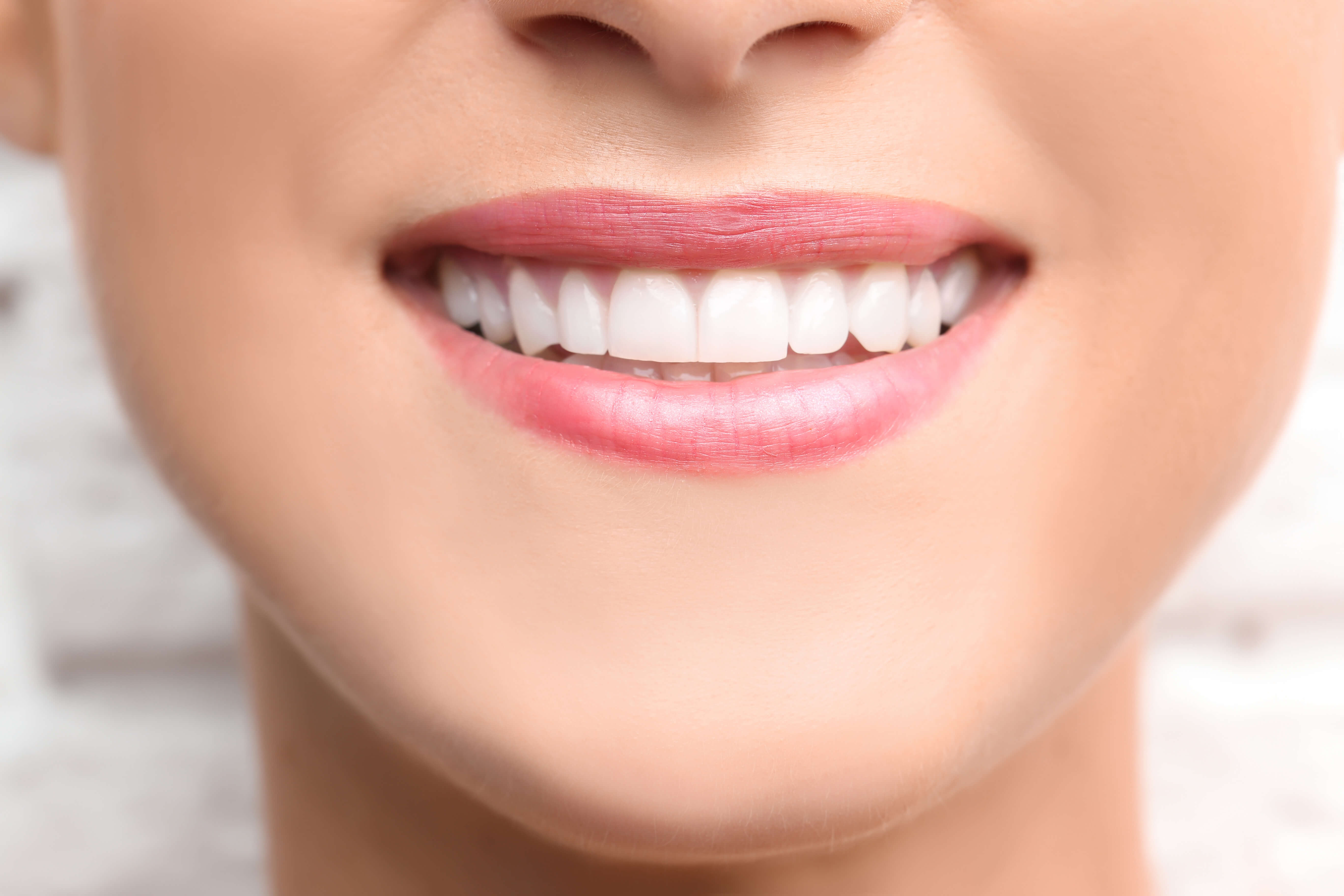Teeth Whitening